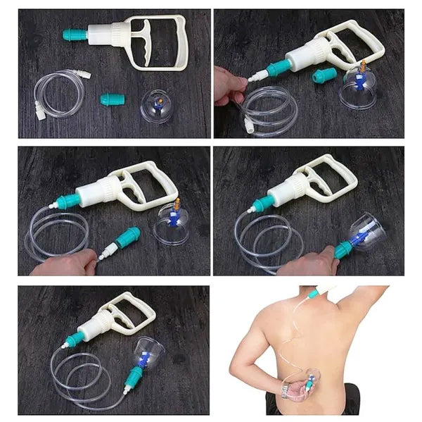 Set 12 ventuze chinezesti+ pompa vacuum pentru  masaj terapeutic, magnetoterapie, acupresura