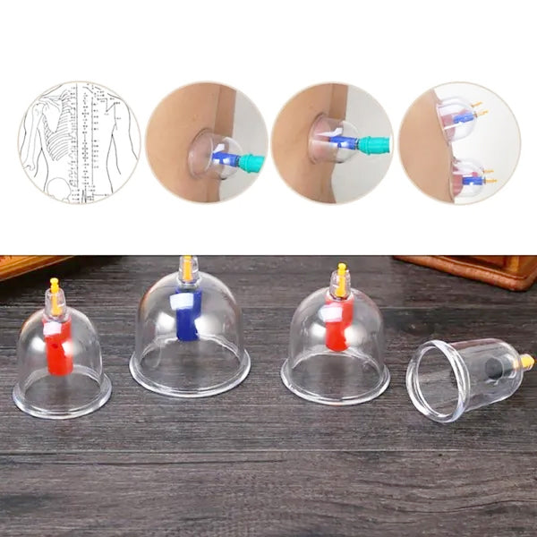 Set 24 cupe de masaj terapeutic cu vacuum, magnetoterapie, acupresura, Ecoterapia®
