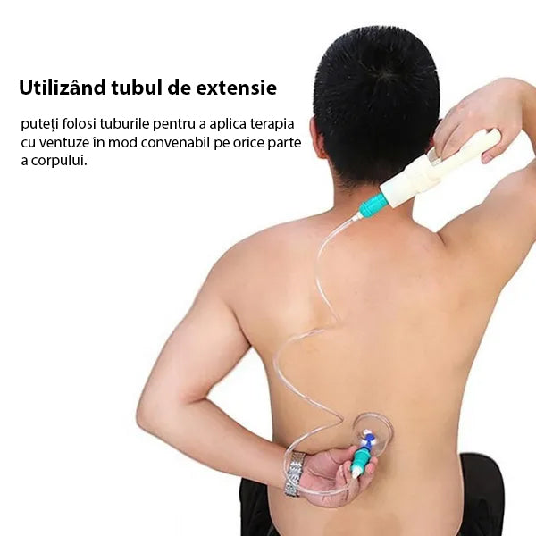 Set 24 cupe de masaj terapeutic cu vacuum, magnetoterapie, acupresura, Ecoterapia®